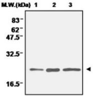 PAB1196 - Superoxide dismutase 2 / SOD2