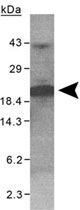 PAB11978 - XAGE-1 / G antigen family D member 2