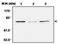 PAB1198 - Thioredoxin reductase 1 / TXNRD1