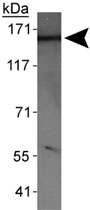 PAB11982 - WHSC1L1 / NSD3