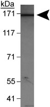 PAB11983 - WHSC1L1 / NSD3
