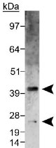 PAB11986 - VEGF-A