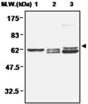 PAB1199 - Thioredoxin reductase 2 / TXNRD2