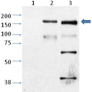 PAB11990 - TRPM2 / TRPC7