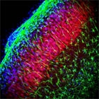 PAB11990 - TRPM2 / TRPC7