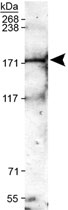 PAB11991 - TRPM2 / TRPC7