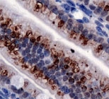 PAB11992 - TRPA1