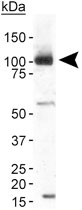 PAB11992 - TRPA1