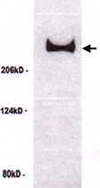 PAB11994 - TP53BP1