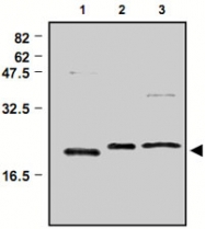 PAB1200 - Peroxiredoxin-3 / PRDX3
