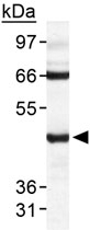 PAB12006 - TARDBP