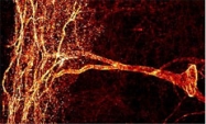 PAB12008 - Tachykinin receptor 1 (TACR1)