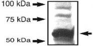 PAB12011 - SYVN1