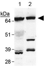 PAB12020 - SREBF1 / SREBP1