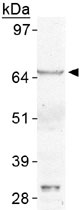 PAB12021 - SREBF1 / SREBP1