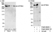 PAB12022 - Spectrin beta III / SPTBN2