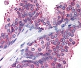 PAB12022 - Spectrin beta III / SPTBN2