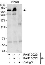 PAB12023 - Spectrin beta III / SPTBN2