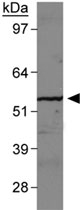 PAB12030 - SLC2A9 / GLUT9