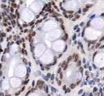 PAB12031 - GLUT1 / SLC2A1
