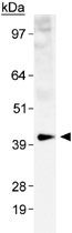 PAB12031 - GLUT1 / SLC2A1