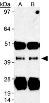 PAB12032 - SIRT7