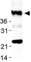 PAB12033 - SIRT7