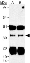 PAB12034 - SIRT7