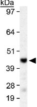 PAB12036 - SIRT6