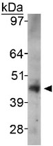 PAB12037 - SIRT6