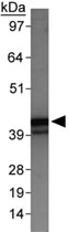 PAB12039 - SERPINB5 / Maspin
