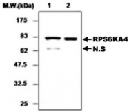 PAB1204 - MSK2