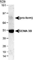 PAB12040 - SEMA3B