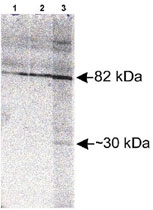 PAB12041 - SCARB2