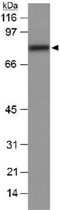 PAB12042 - SCARB1