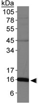 PAB12045 - S100A9 / Calgranulin-B / MRP14