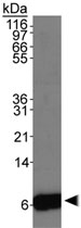 PAB12046 - S100A6 / Calcyclin