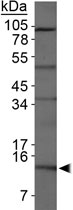 PAB12047 - S100A12