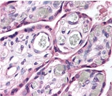 PAB12048 - ROBO4 / Tumor Endothelial Marker