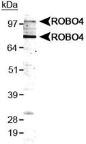 PAB12049 - ROBO4 / Tumor Endothelial Marker