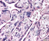 PAB12049 - ROBO4 / Tumor Endothelial Marker