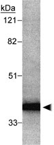 PAB12051 - RAD51L3