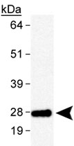PAB12054 - PTGDS