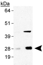 PAB12055 - PTGDS