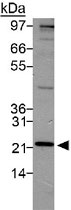 PAB12056 - PSMD10 / Gankyrin