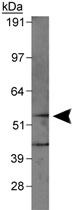 PAB12059 - PRAME / MAPE