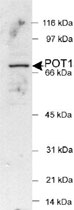 PAB12064 - POT1