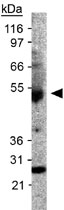 PAB12068 - Podocalyxin / PODXL