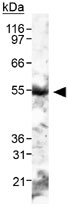 PAB12069 - PNPLA2 / ATGL