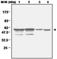 PAB1207 - Glutathione reductase